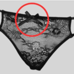 Veines apparentes : comprendre, observer et agir